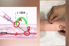 输液拔针后常常还会流血？多是按压方式不当视频封面