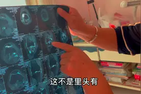 老妈的腿最近吃药好了很多，现在就是需要养，谢谢大家的关心视频封面