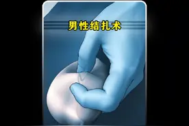 一分钟带你了解结扎全过程。#知识科普 #科普一下 #知识分享视频封面