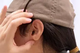 美女做了耳垂裂修复，以后可以戴漂亮的耳饰了。  #耳垂裂 #耳垂裂术后效果图片 #耳再造钱瑾#八大处钱瑾 #医途暖光视频封面