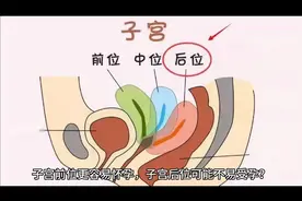 女性子宫在盆腔内的位置分为子宫前位、子宫中位和子宫后位三种