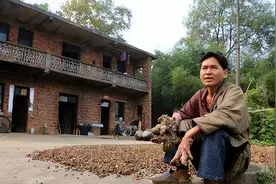 “树人”刘忠文:双手长满树枝，生活无法自理，穿衣吃饭父母代劳图片