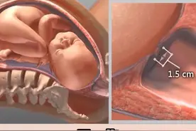 男生必修课：顺产生孩子过程！一组3D图告诉你，女人很伟大图片