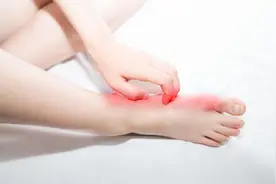 我国脚气患者过亿，“祸根”被揪出：这些东西是脚气最大的帮凶图片