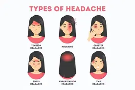 头痛常见病因，总结了20种，太全了！图片