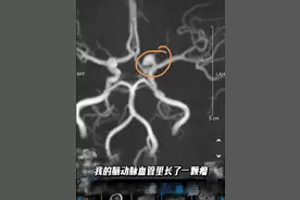 "是宝宝救了我..."知名女星哽咽自曝二胎没了，脑中长了“定时炸弹”！图片