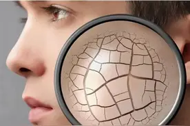 嘴唇干裂总不好？可能是这3种病在发作，最后一种90%的人都忽略了图片