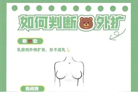 xiong外扩的辨别方法图片