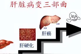 慢性乙肝患者为什么强调要做高灵敏HBVDNA定量检测？（一）图片