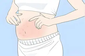 🌈 孕期皮肤「保卫战」：瘙痒、红疹、妊娠纹？教你轻松拿捏！图片