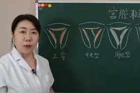 宫腔粘连是怎么回事？哪种情况必须手术？图片