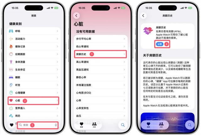 Apple Watch房颤历史功能设置