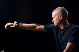 人体也能对蛇毒免疫？被毒蛇咬了200多次后，男子获得超级免疫力图片