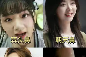 常见的四大丑鼻，对颜值的影响有多大，看完这几组对比图就懂了图片