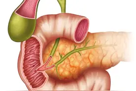 右上腹隐痛别硬扛！3 种情况要立即就医图片