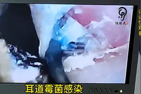 河津市任佬大全程3D可视采耳🔥#解压图片