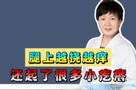 腿上越挠越痒 还起了很多小疙瘩 #医学知识科普视频封面