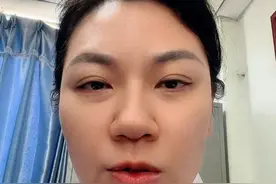 乙肝超声出现这6个字，很可能是肝纤维化，别不当回事！ #科普 #乙肝 #肝纤维化 #肝硬化 #山东视频封面