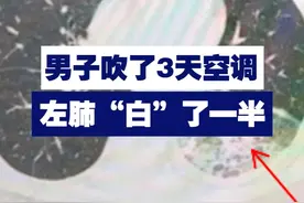 【男子吹了3天空调 左肺“白”了一半！】近日，成都的李先生吹了3天空调，患上严重的军团菌肺炎，左肺“白”了接近一半。视频封面