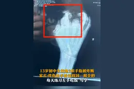 2月3日，福建泉州，13岁初中生放炮3根手指被炸断，家长:炸伤的手指没找到一根全的。目前右手不能使用，每天练习左手吃饭、写字。视频封面