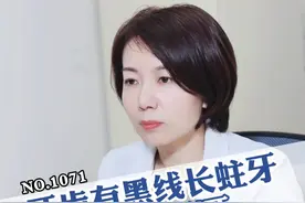 不想因为蛀牙花几千上万去治疗，先从正确刷牙开始！#科普 #蛀牙 #根管治疗 #巴氏刷牙法 #智能牙刷Y20视频封面