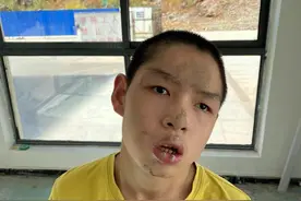 怀化寻亲：12岁男孩被救助，穿黄色T恤，赤脚，头部有多处疤痕图片