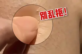 手臂、大腿上疙疙瘩瘩很难看，皮肤科医生教你低成本处理#鸡皮#鸡皮疙瘩#变美#硬核健康科普行动10%#尿素身体乳视频封面