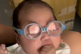 戴上眼镜才能看清一点点！#2个月的宝宝近视竟2000多度  ，“妈妈系残疾人患有白内障，宝宝查出先天性白内障，已做手术”，医生：术后易复发青光眼#白内障  #近视 #青光眼视频封面