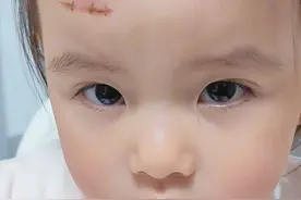 自从小诺受伤后，额头的伤口一直让人揪心。四处寻医问药之后总结了三个淡化疤痕的方法，希望大家都不要用上……#爸爸带娃 #亲子 #疤痕