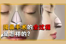 隆鼻手术有多可怕？它的全过程是怎样的？看完涨知识了视频封面