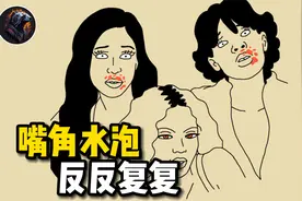 嘴角的水泡为什么反反复复？带你了解背后的秘密