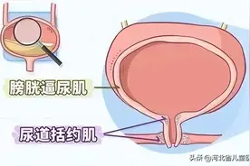 河北省儿童医院开展小儿尿动力学检查！图片
