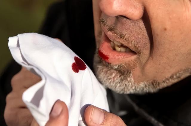 但是因为咳嗽没有好,又因劳心劳力过度,从而心中发热,导致吐血