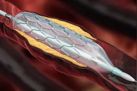 36岁男子花80万彩礼娶56岁的富婆，一年后做了心脏支架的富婆离世图片