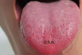 舌紫有瘀血，舌浅多血虚，舌红多有火，5个中成药，活血养血清热图片