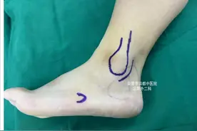 转脚时脚踝咔咔响，可能是这根“会跳舞的筋”滑脱了！图片