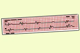 心率60次和80次的，会有什么不同？什么样的心率更易长寿？图片