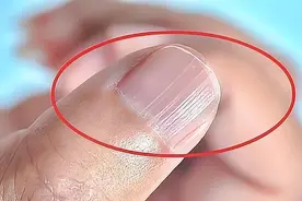 指甲上有竖纹，究竟是咋回事？是老人说的肝不好吗？看完涨知识了图片