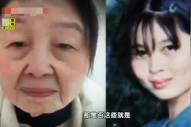 16年前，19岁女子生产后一夜老成80岁，整形4次，她变年轻了吗？图片
