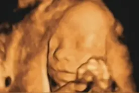 为什么彩超医生都不告诉是男孩还是女孩呢？图片