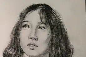 桡骨远端骨折是保守还是手术治疗？不要后悔莫及图片