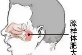 怕孩子睡觉张嘴打呼噜会变丑 杭州妈妈使用矫正贴 却引发孩子频频噩梦……图片