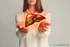 从根源治疗肝腹水，中医中药带您重返健康！图片