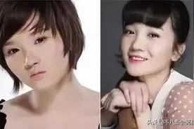 女星整容一直在路上：沈梦辰近照不敢认，杨子姗换个角度就变脸图片