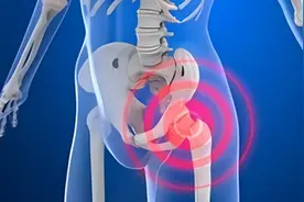 这些部位的疼痛，您得小心股骨头坏死图片