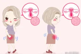 私处瘙痒？异味？......难受又尴尬！来，学会这几招就够了图片