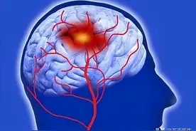 脑出血来临，睡觉先知？医生提醒：睡觉出现5个异常，小心脑出血图片