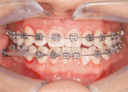 ҽرǿݽ⼸һҪע⣡