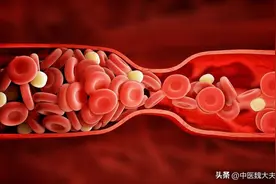 冠心病严重吗？总感觉呼吸困难或因冠心病引起图片