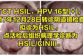 认真管理好每一位宫颈图片